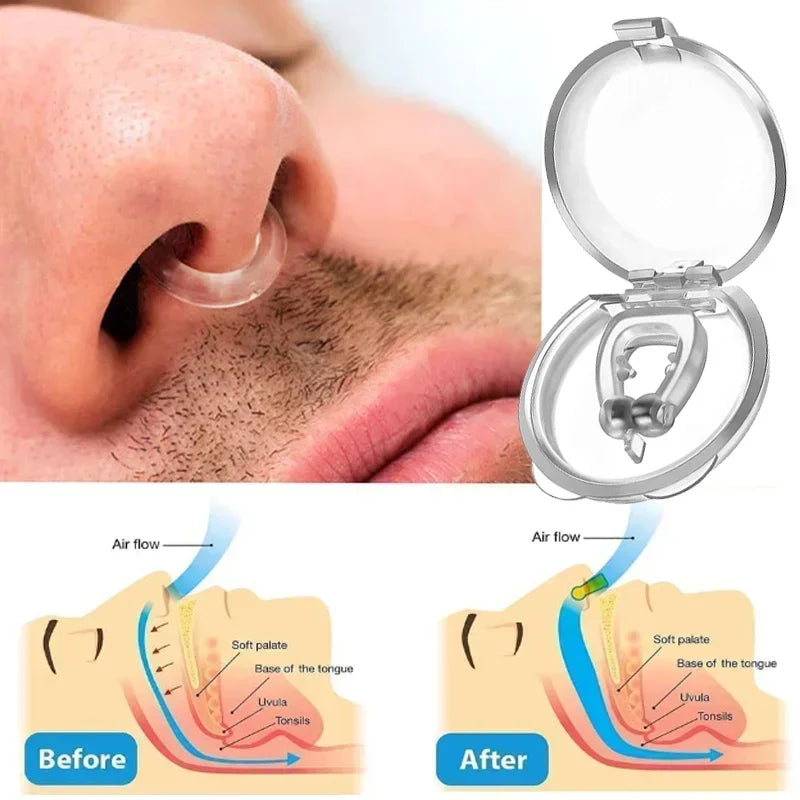 Clip Anti-Ronflement en Silicone